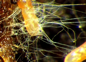 A imagem mostra hifas de fungo se formando: fios que constituem a característica dos mofos e bolores.